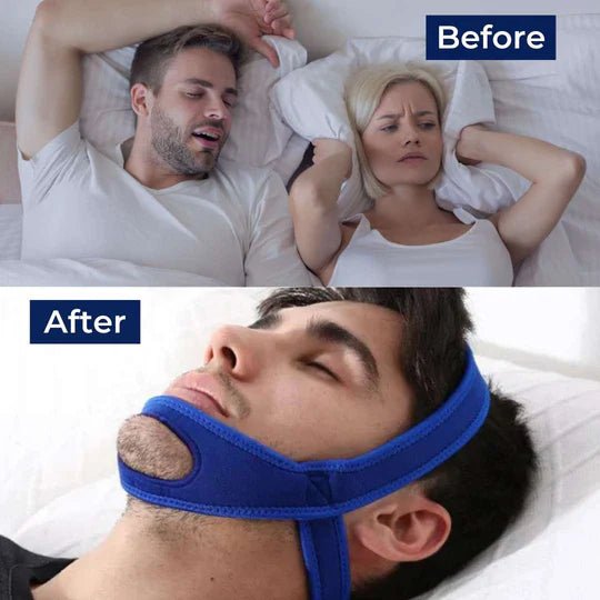 Full Head Chin Strap for Snoring Relief | Sleep Apnea Support - Comfortable - Night Use image 8