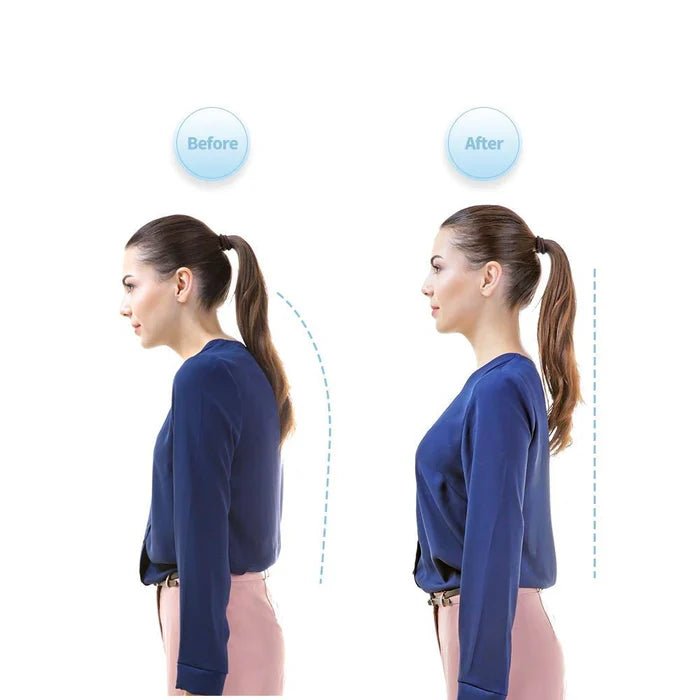 Smart Posture Corrector - Neck Hump Straightener Improve Your Posture for Adult and Kid image 4