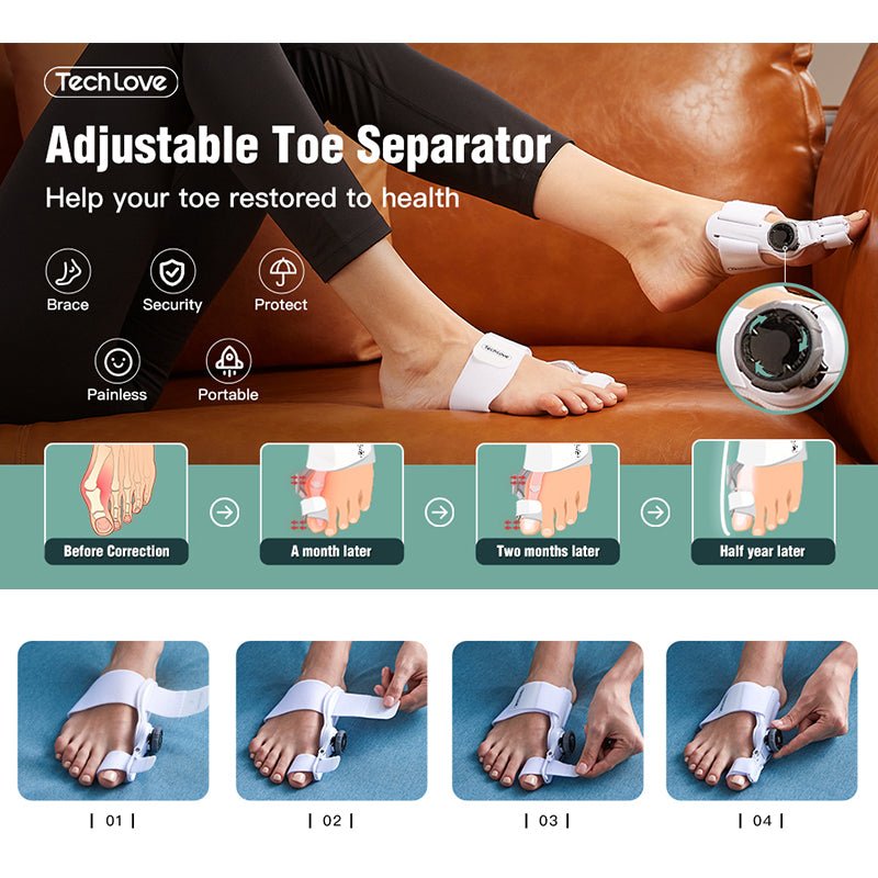 Upgraded Bunion Corrector - 3D Knob Toe Corrector image 2