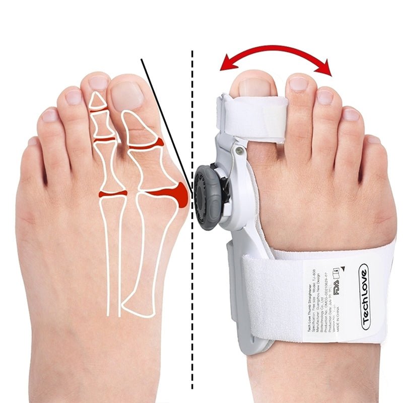 Upgraded Bunion Corrector - 3D Knob Toe Corrector image 8