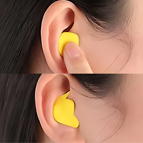 Ear Plugs for Snoring – Noise-Reducing Silent Earplugs for Sound Elimination and Peaceful Sleep image 6