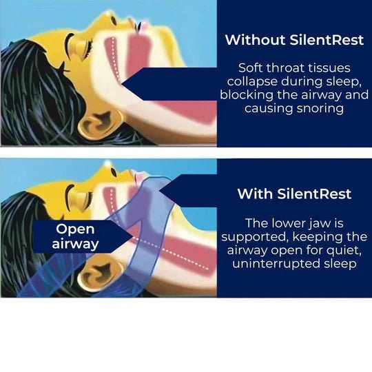 Full Head Chin Strap for Snoring Relief | Sleep Apnea Support - Comfortable - Night Use image 6