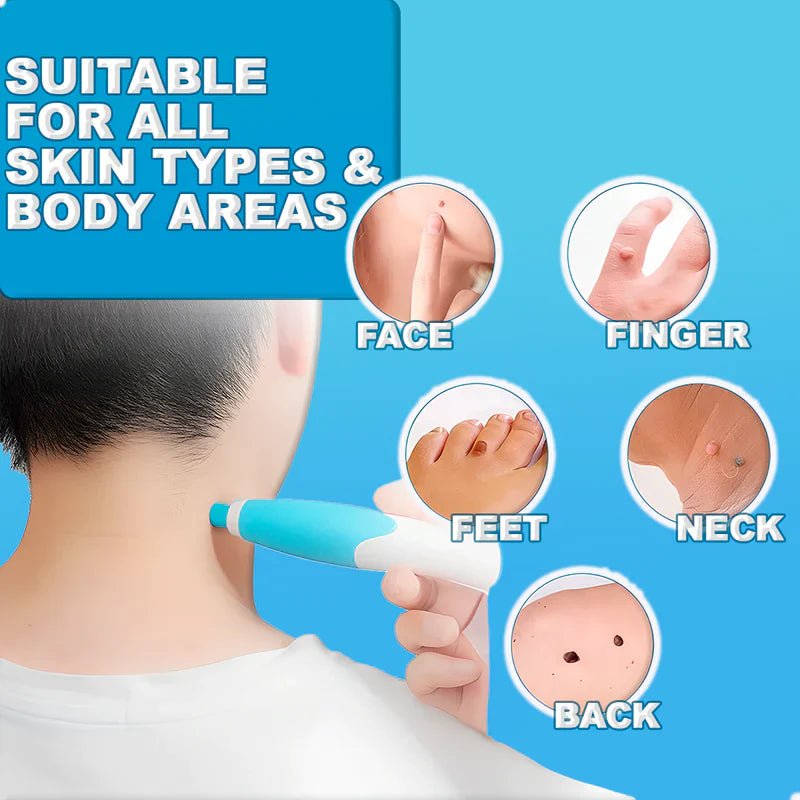 Painless Skin Tag Remover image 2
