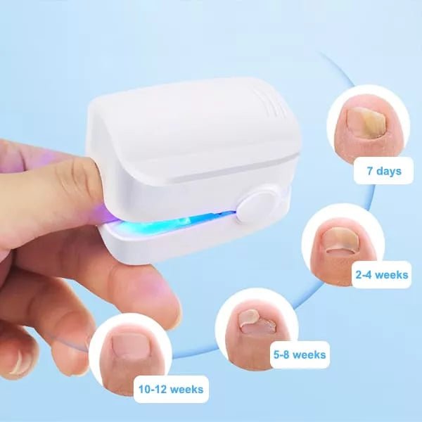 Nail Fungus Cleaning Laser Device image 2