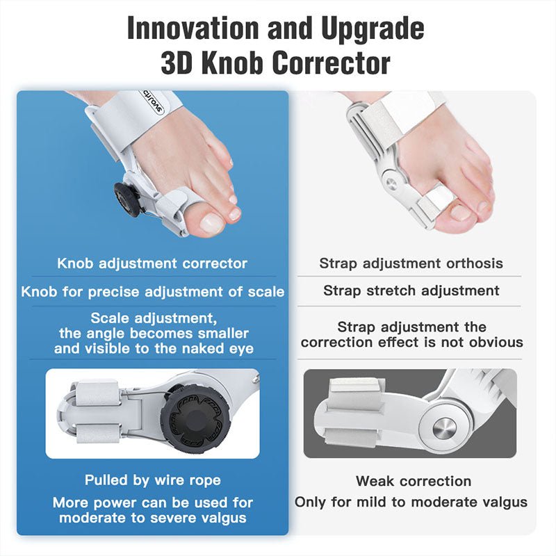 Upgraded Bunion Corrector - 3D Knob Toe Corrector image 6