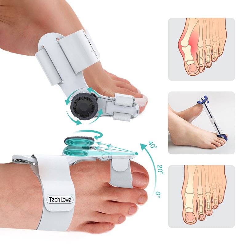 Upgraded Bunion Corrector - 3D Knob Toe Corrector image 3