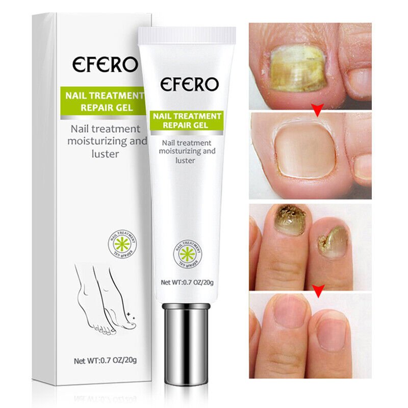 Nail Repair Treatment Gel - Image 3