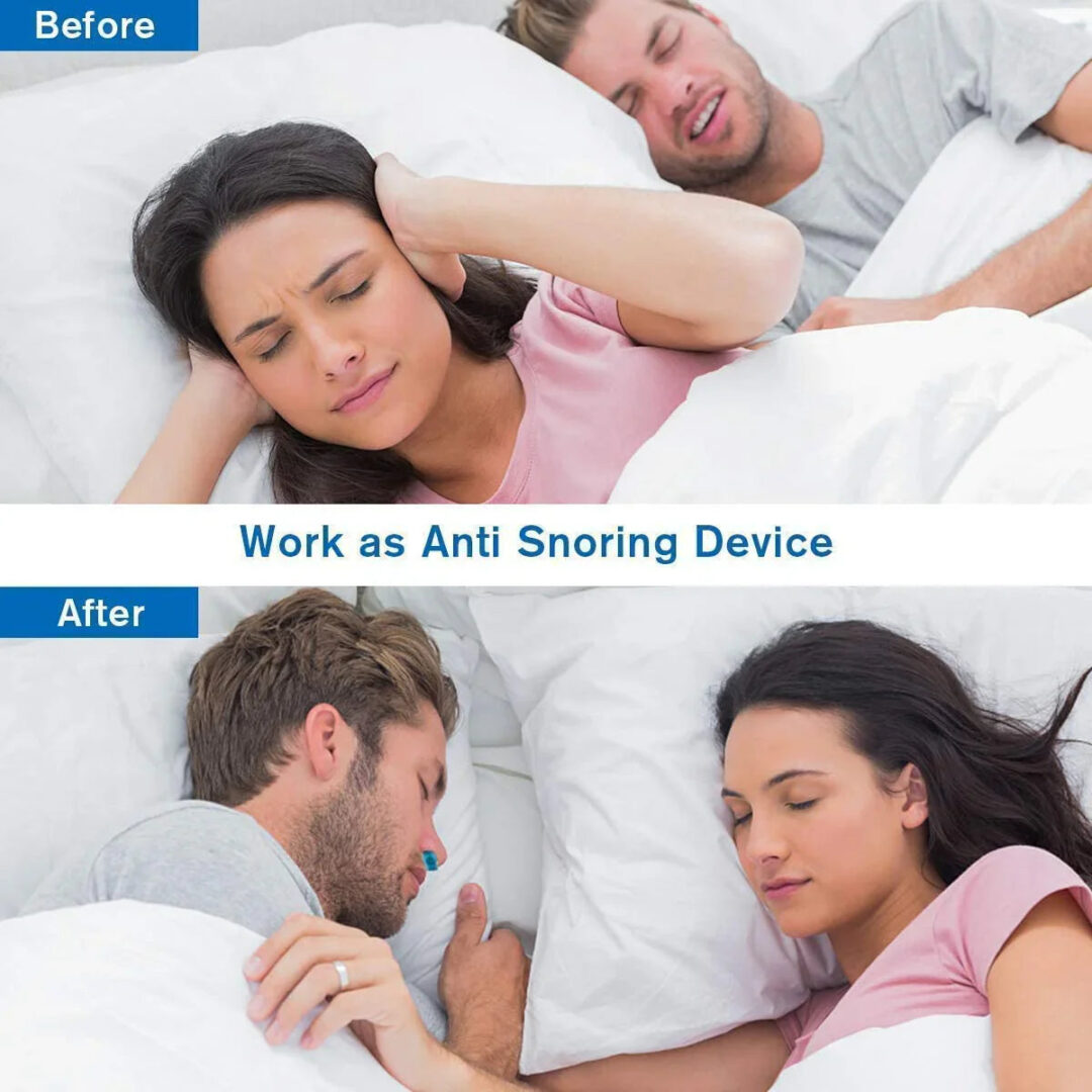Airing Micro-CPAP Device for Hassle-Free Anti-Snoring Relief - Image 7