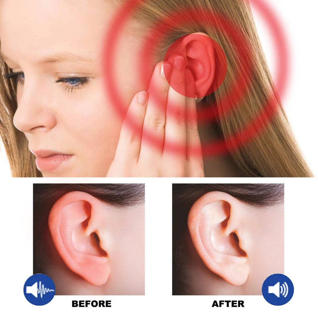 2 Set Tinnitus Ringing Ears Drops - Image 6
