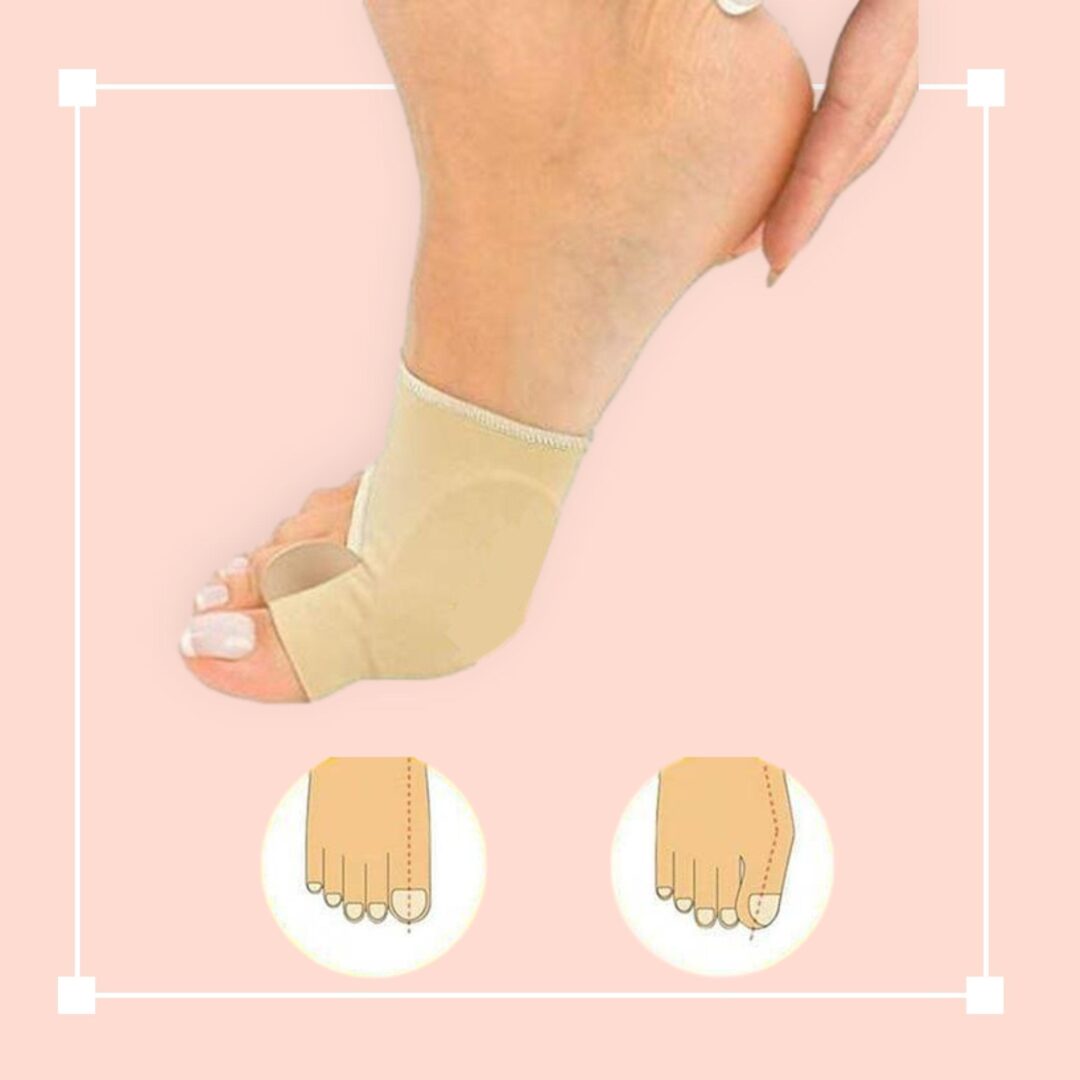 Orthopedic Toe Bunion Corrector - Image 7