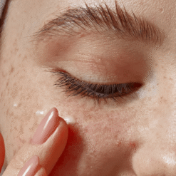 Alternative view of Eye Milia Removal Cream