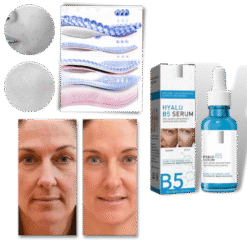 rejuvenating hyalu b5 hyaluronic acid serum wrinkle reduction